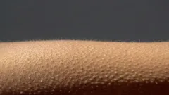 Neurobiologisches Phänomen: Warum bekommen wir Gänsehaut?